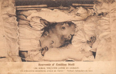 Medecine Monstre Souvenir D'Emilisa Stoll Soeur A Tete Jointes En Croissant -
													France
												